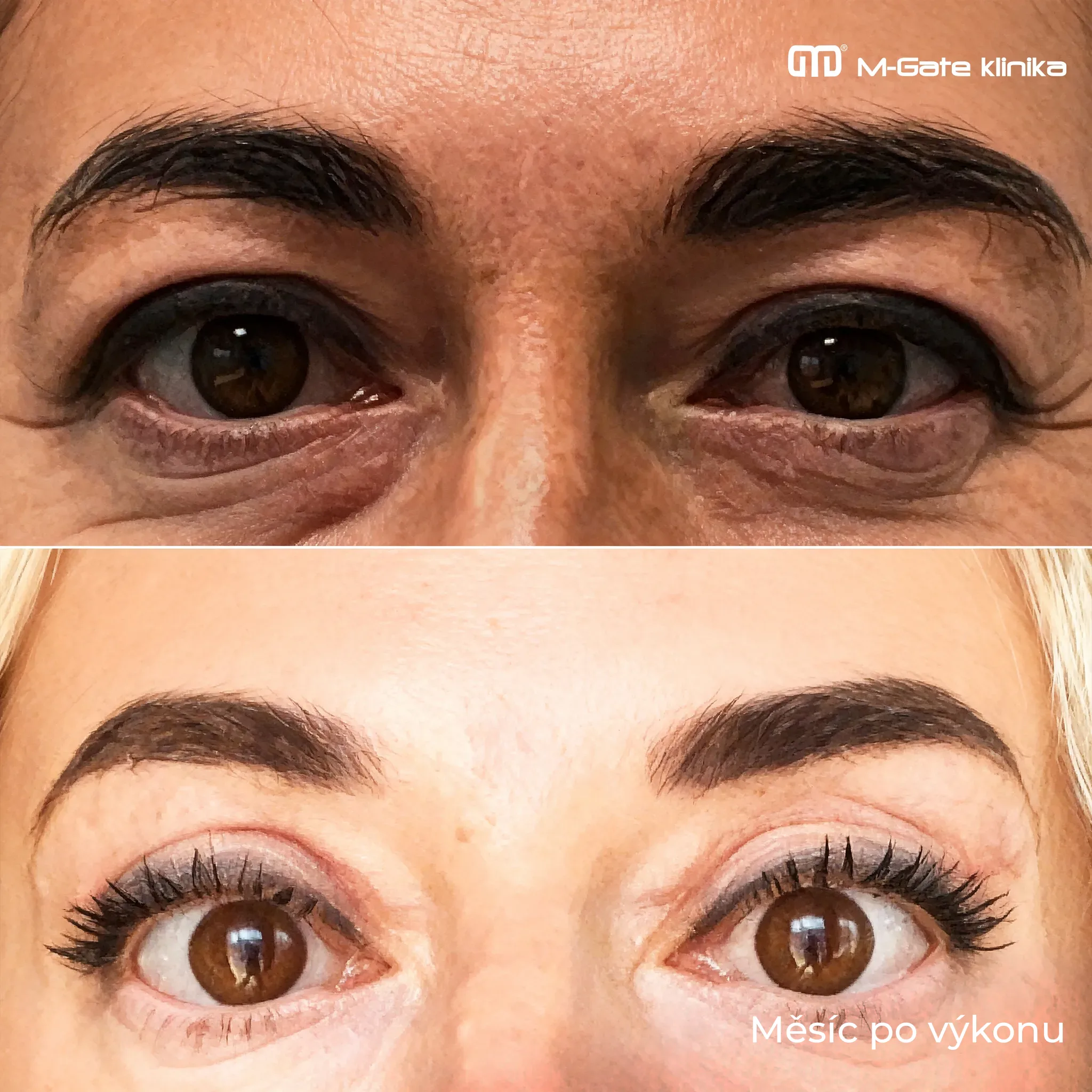 Operace víček - 12