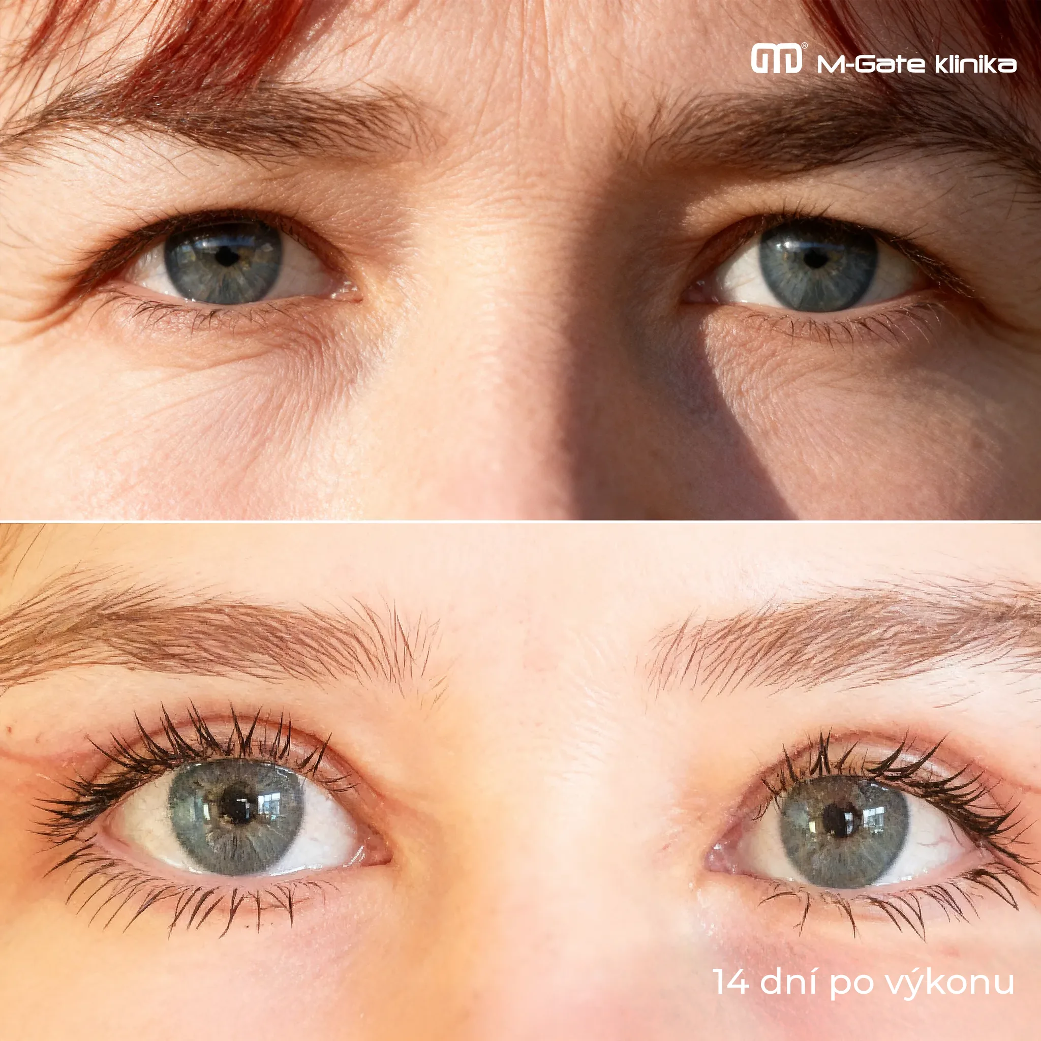 Operace víček - 13