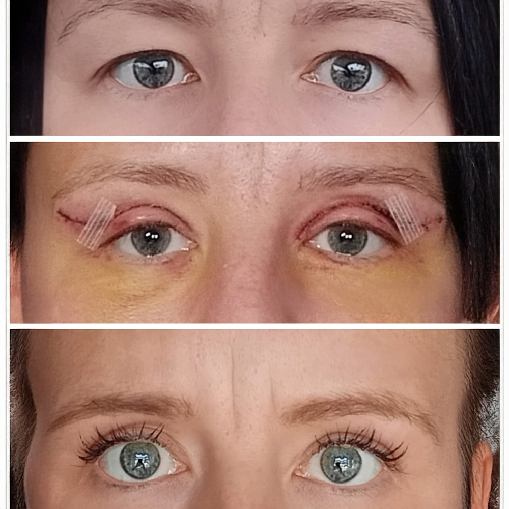 Markéta Jonášová Tlučhořová - víčka