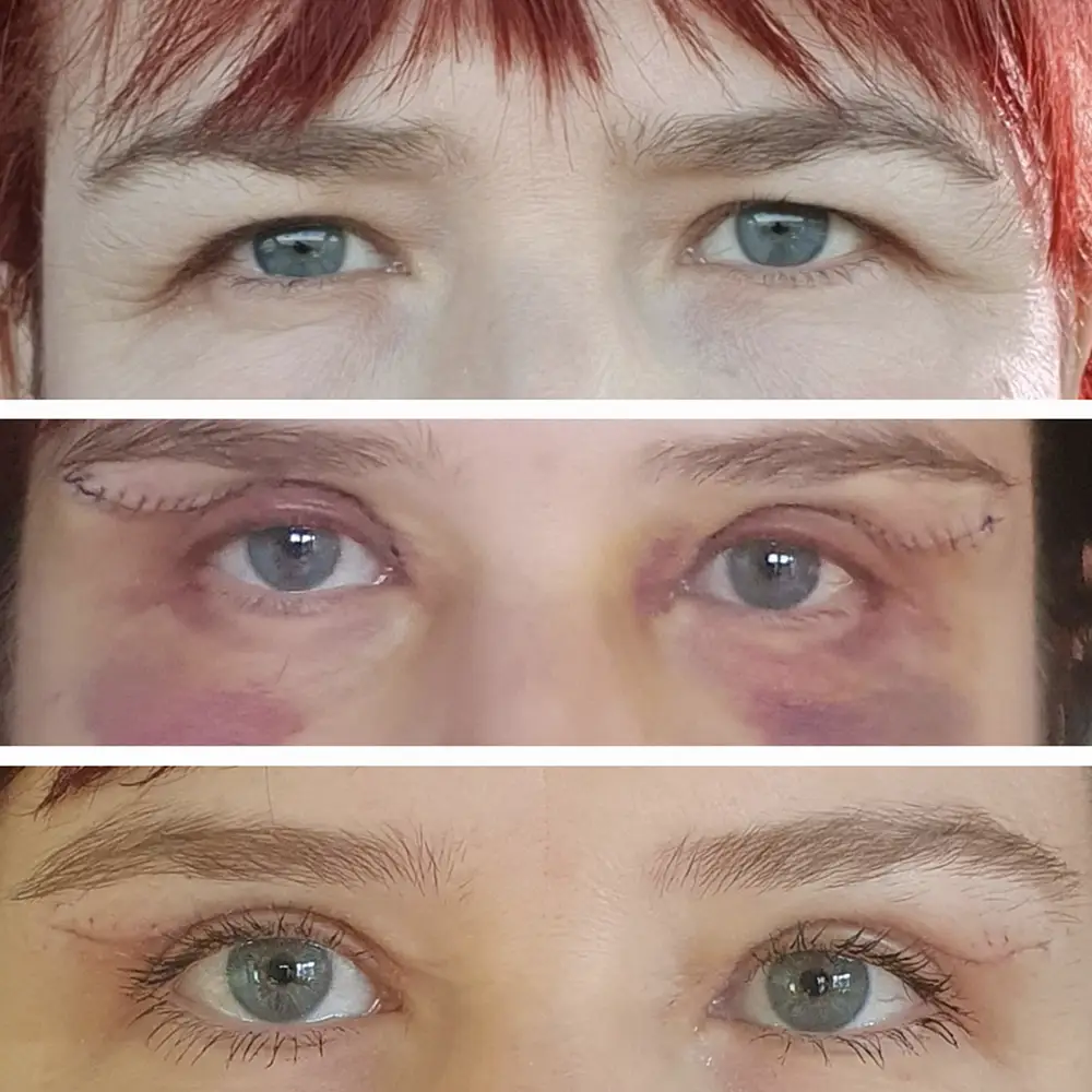 Markéta Čížková - víčka