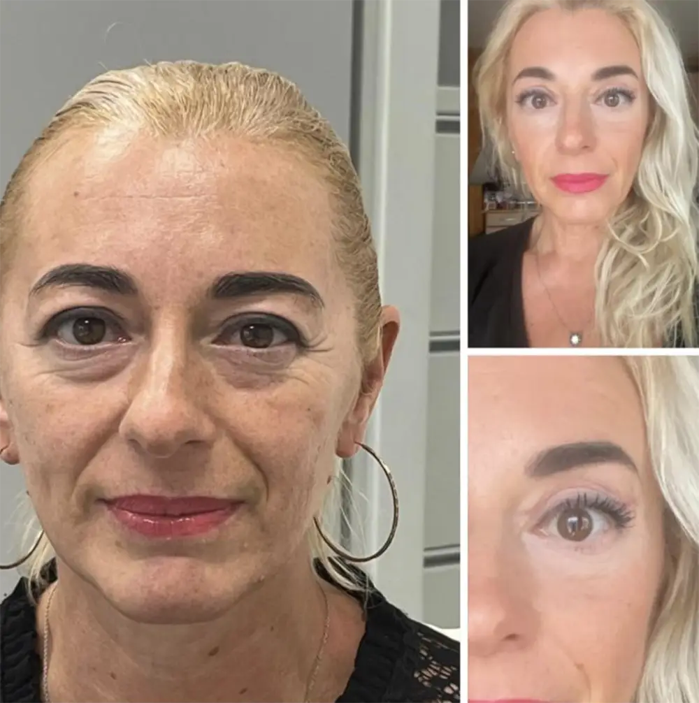 Denisa Háková - víčka