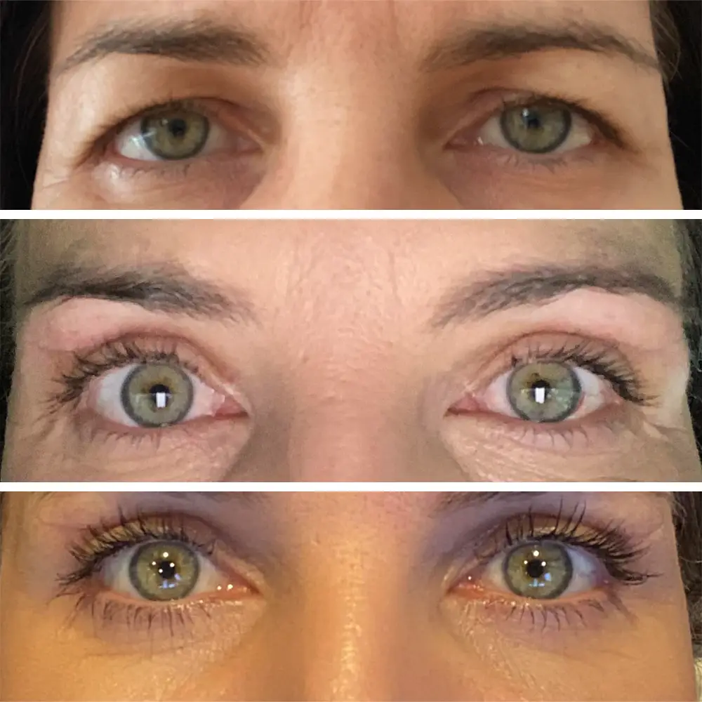 Darina Jettmarová - víčka