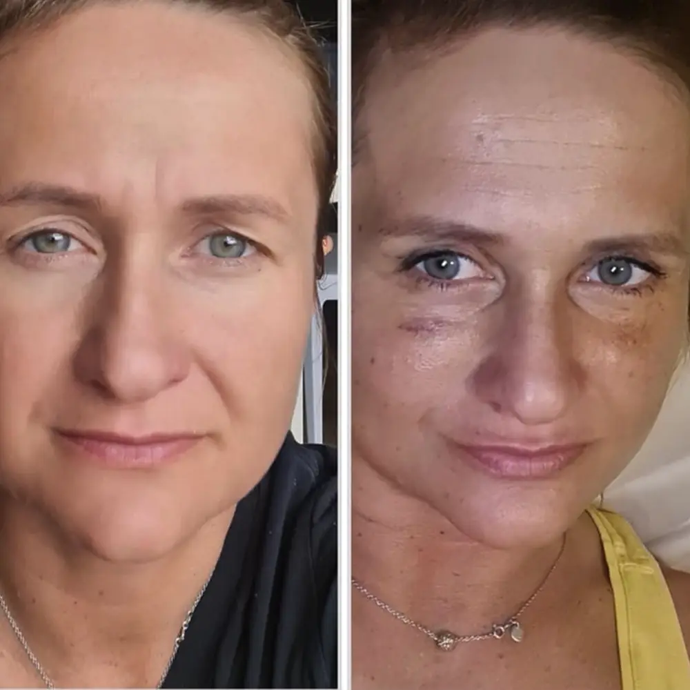 Iveta Srbová - víčka