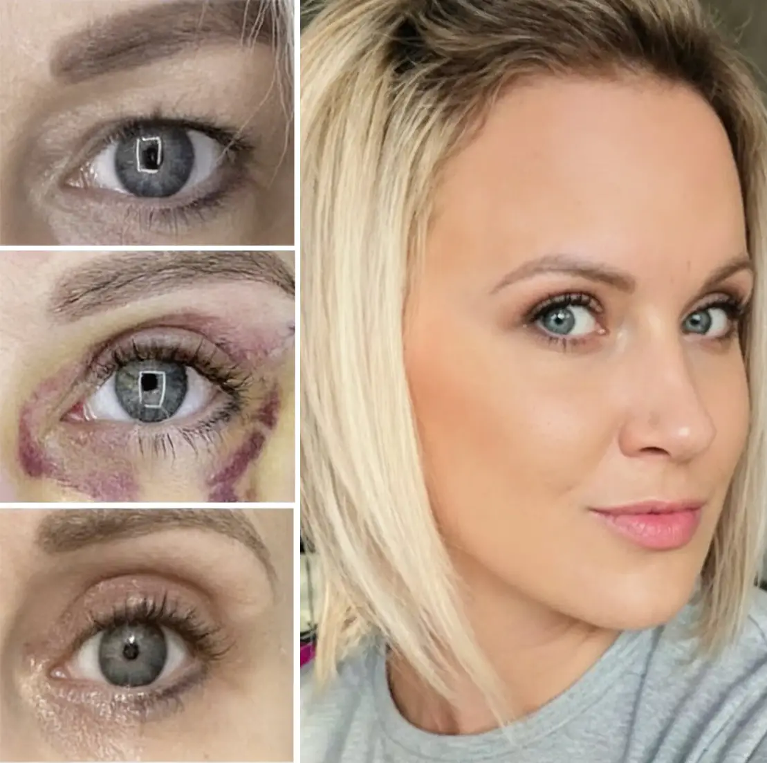 Eva Hovorková - víčka