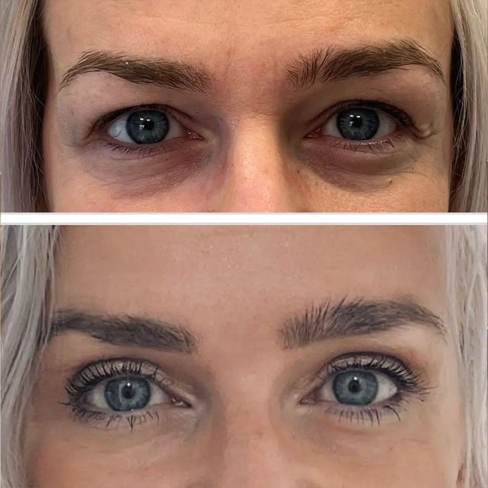 Barbora Chládek - Víčka